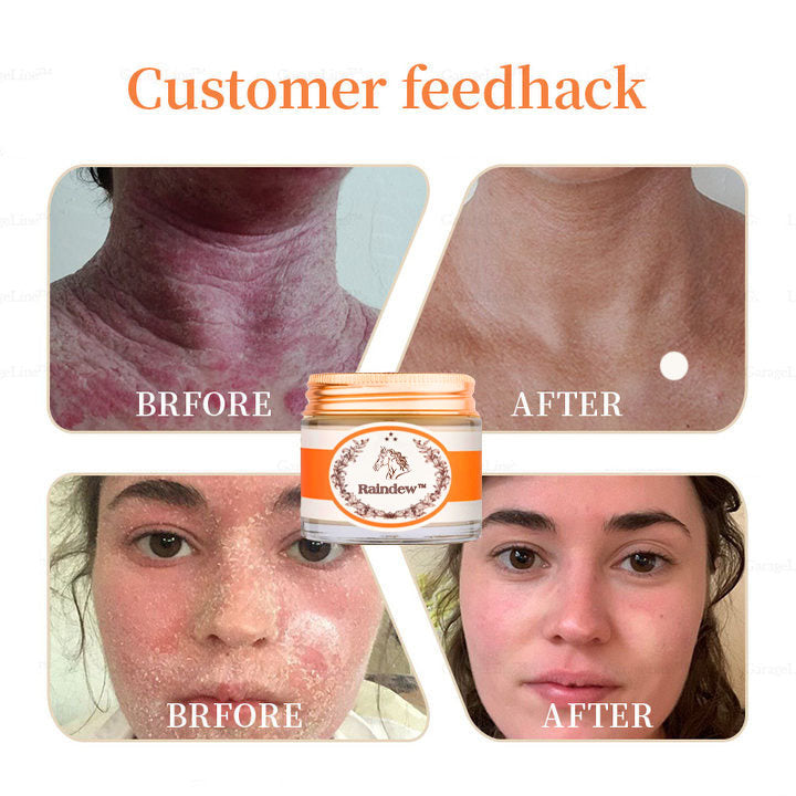 [Official Brand Store🎉]2025 New Horse Oil Therapy Cream (👨‍⚕ACD 𝐑𝐄𝐂𝐎𝐌𝐌𝐄𝐍𝐃𝐒)