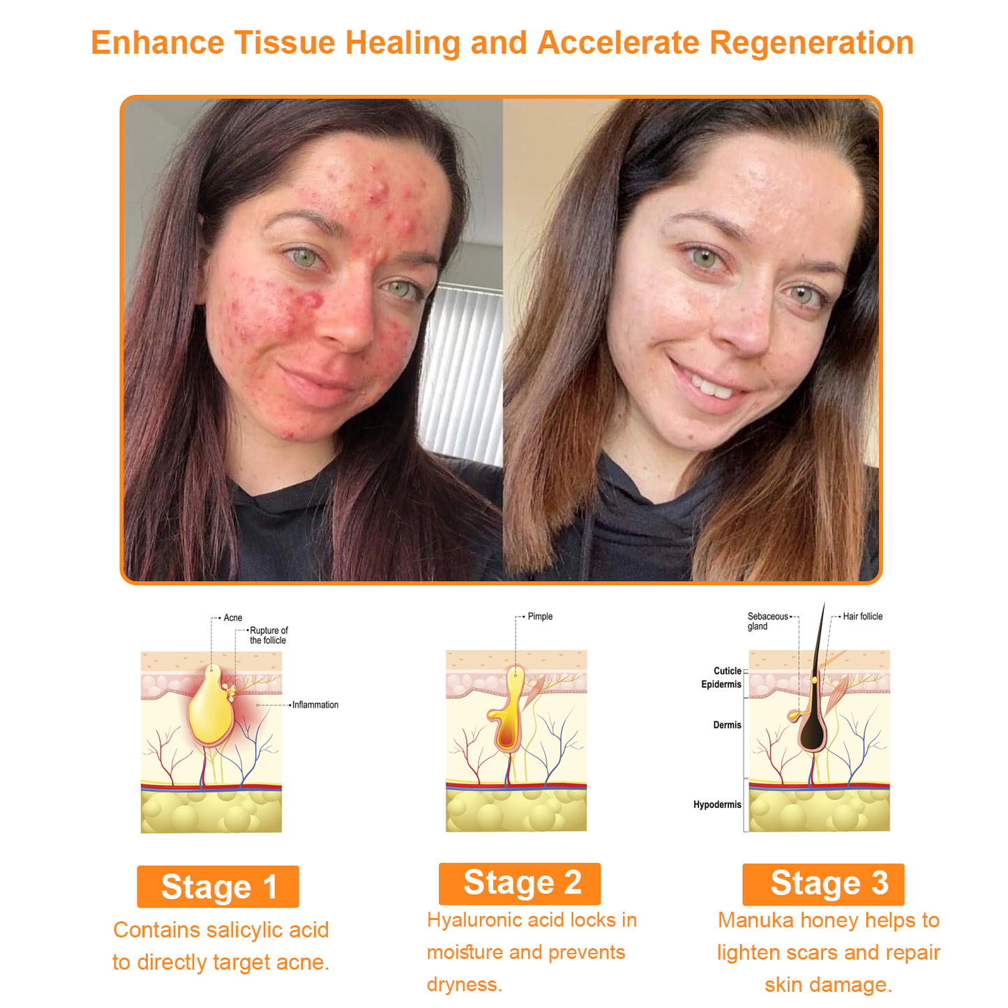 Raindew™ Powerful All-Body Skin Treatment Cream (AAD Recommended)