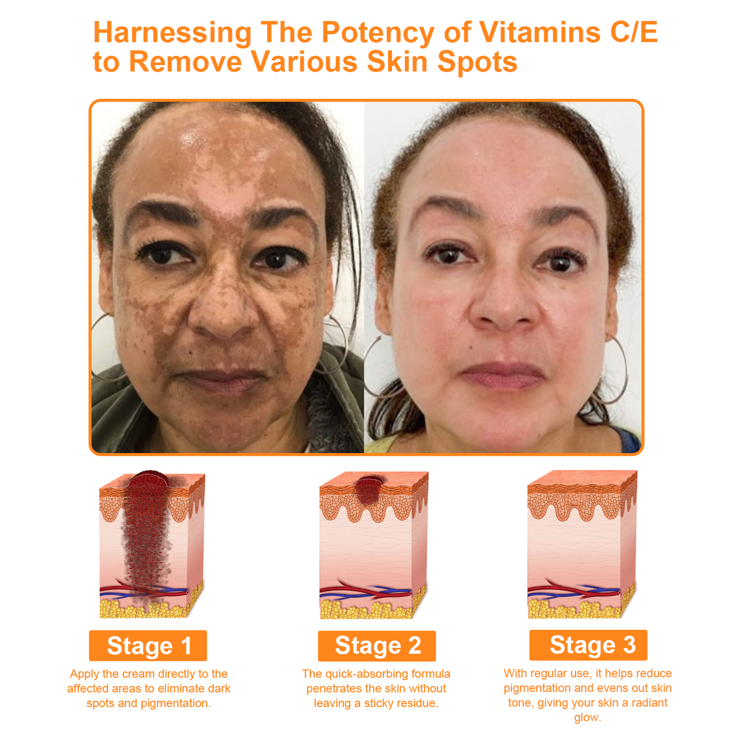 Raindew™ Powerful All-Body Skin Treatment Cream (AAD Recommended)