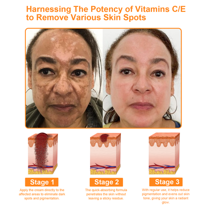 Raindew™ Powerful All-Body Skin Treatment Cream (AAD Recommended)